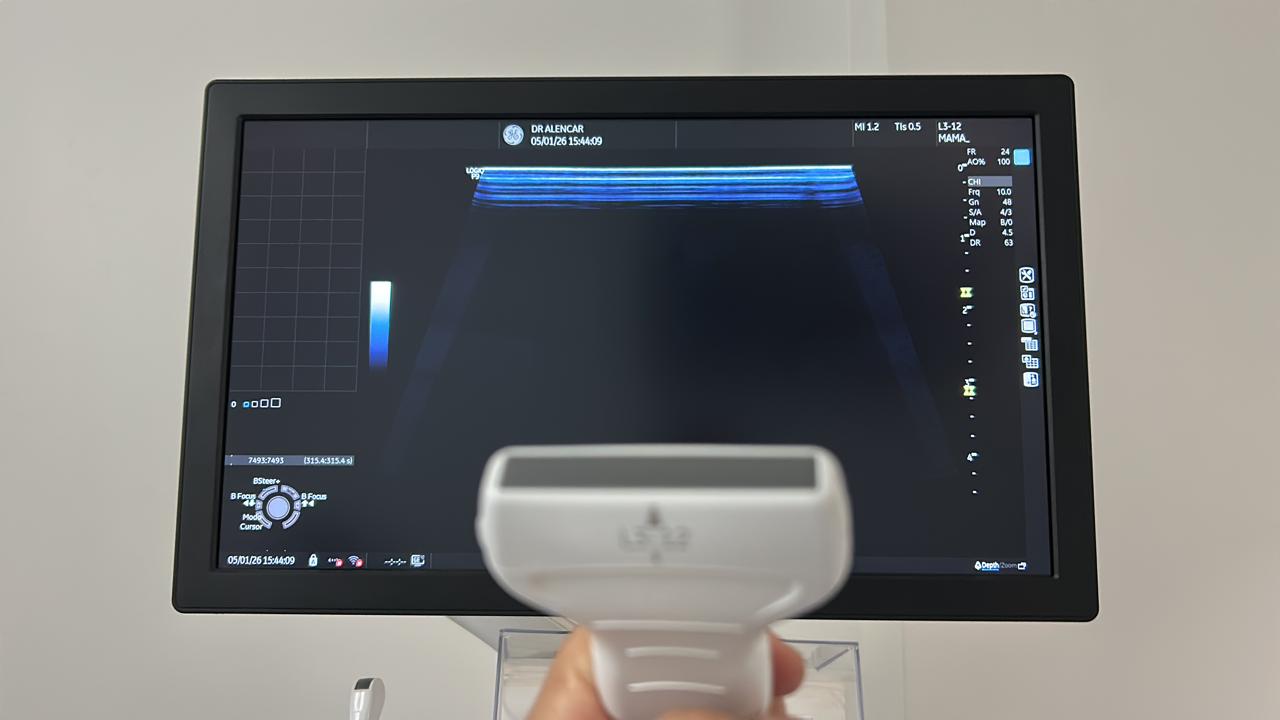 ULTRASSOM GE – LOGIQ P9 SHEAR WAVE - Imagem 4