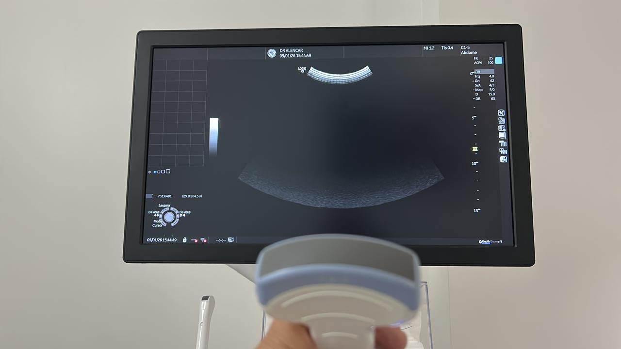 ULTRASSOM GE – LOGIQ P9 SHEAR WAVE - Imagem 5