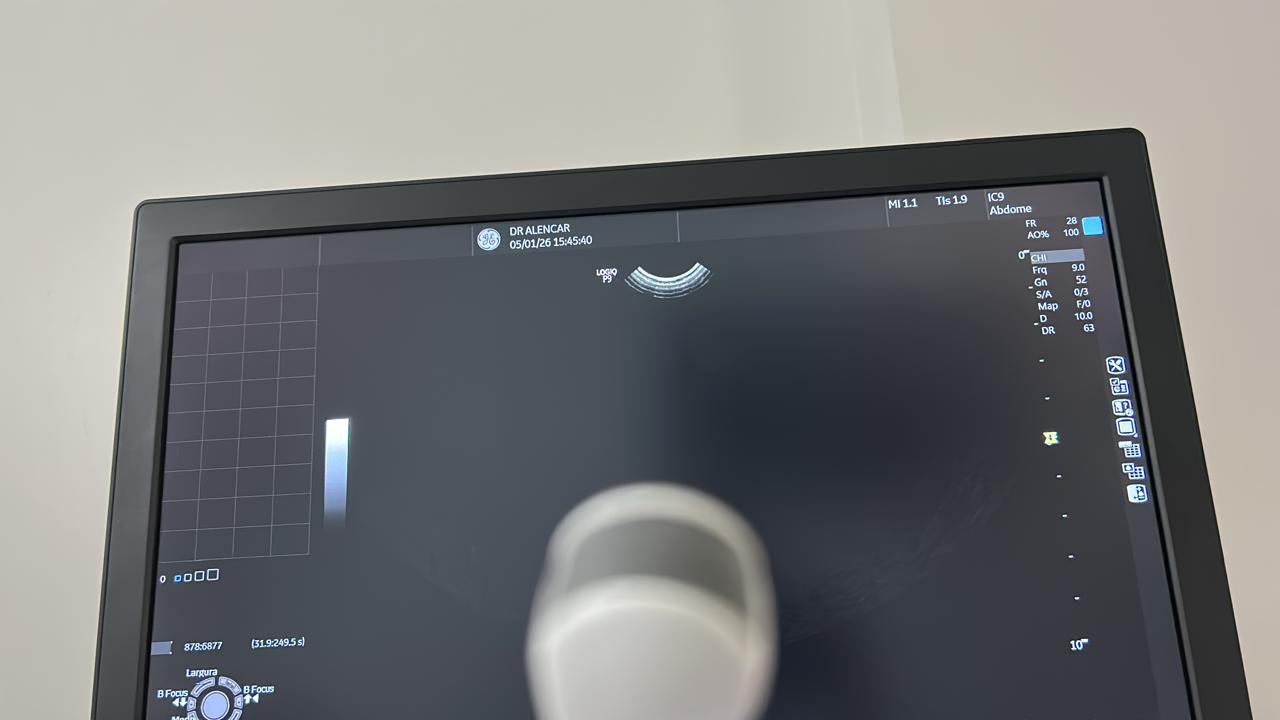 ULTRASSOM GE – LOGIQ P9 SHEAR WAVE - Imagem 6