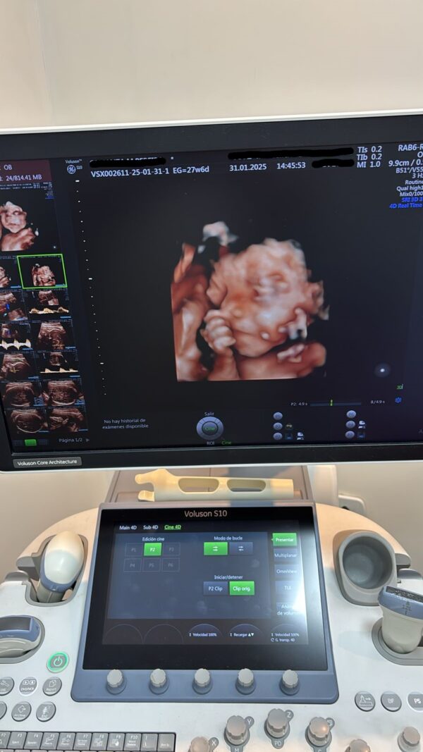 ULTRASSOM GE – VOLUSON S10 HDLIVE 3D/4D - Image 3