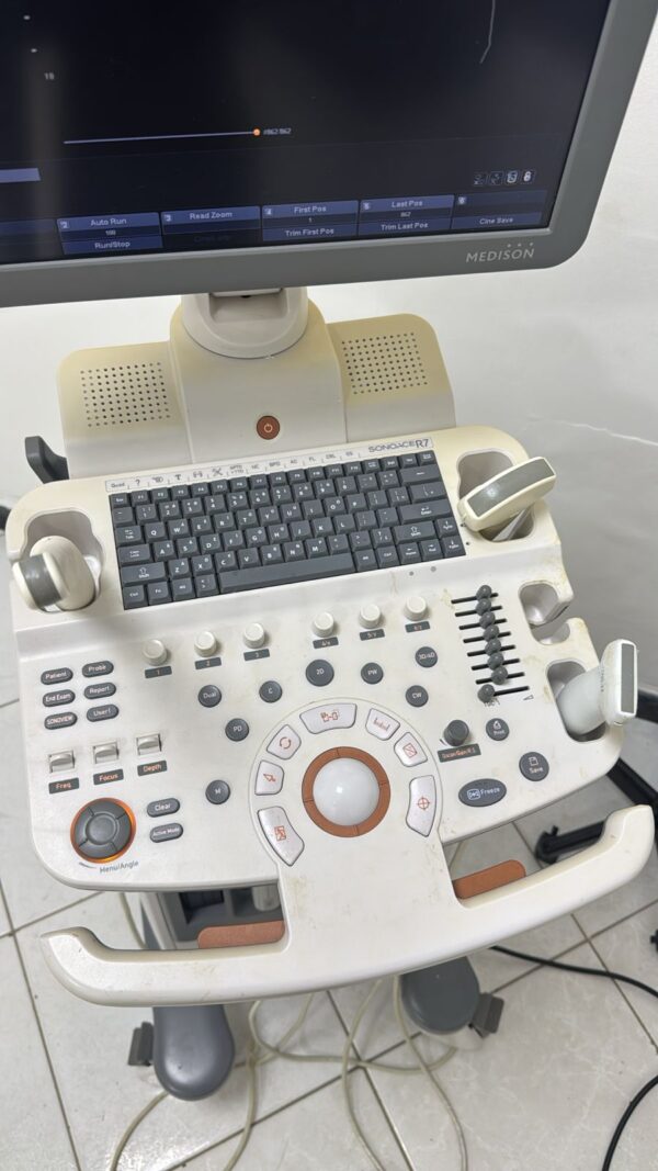 ULTRASSOM SAMSUNG – SONOACE R7 - CARDIO - Image 6