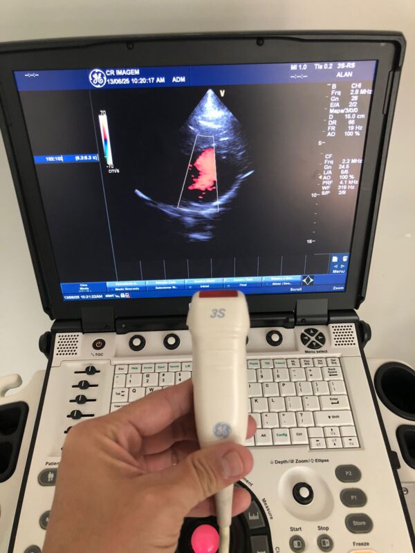 ULTRASSOM PORTÁTIL GE – VIVID E - Image 5