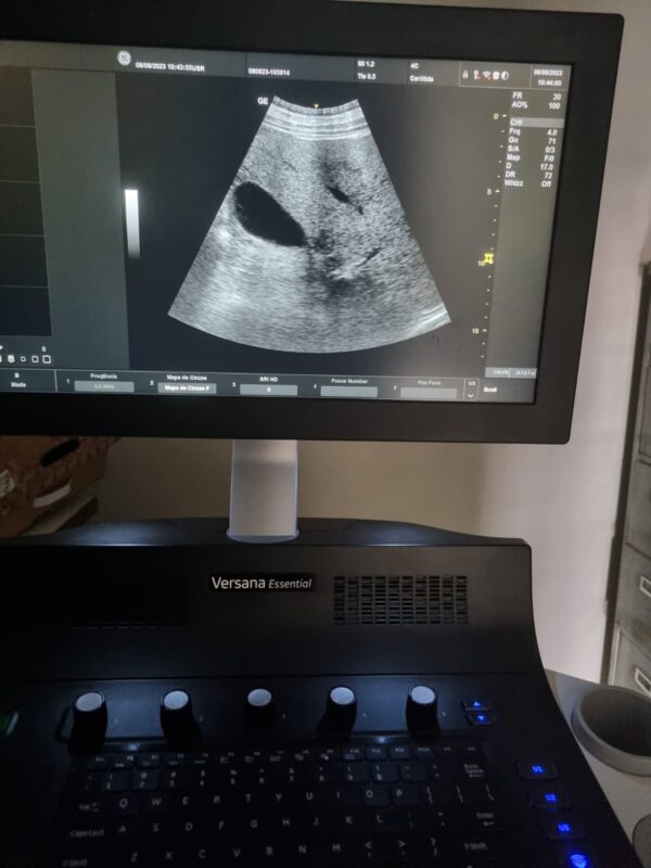 ULTRASSOM GE – VERSANA ESSENTIAL - Image 2