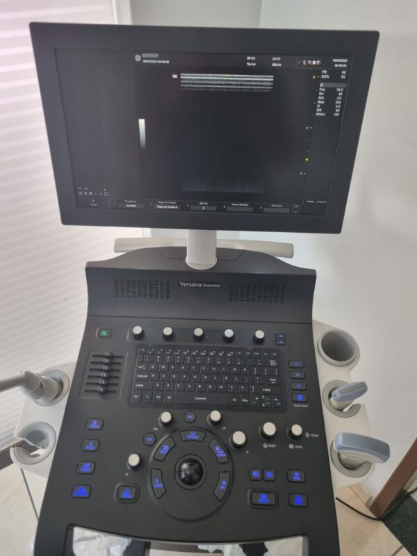 ULTRASSOM GE – VERSANA ESSENTIAL - Image 3