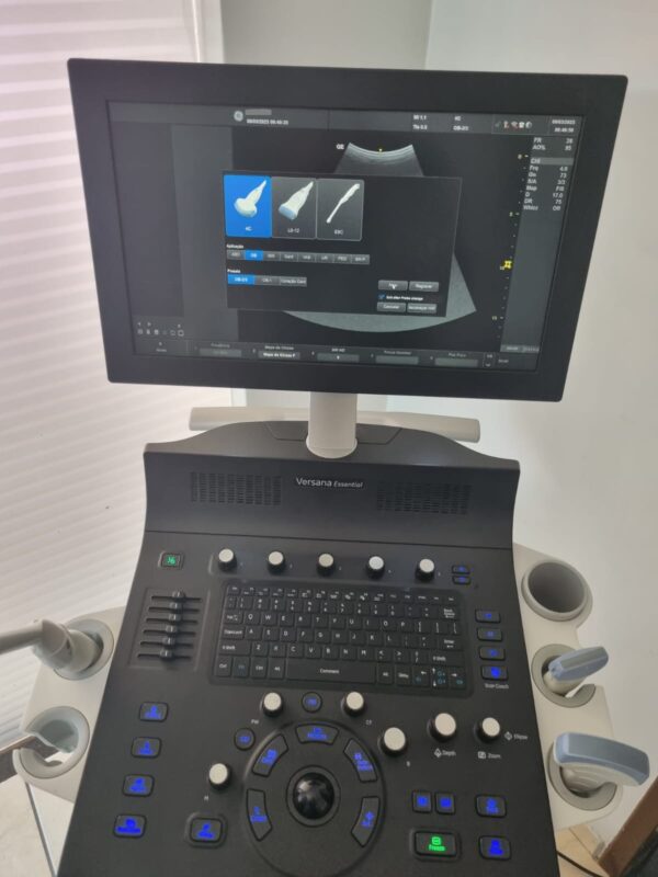 ULTRASSOM GE – VERSANA ESSENTIAL - Image 4
