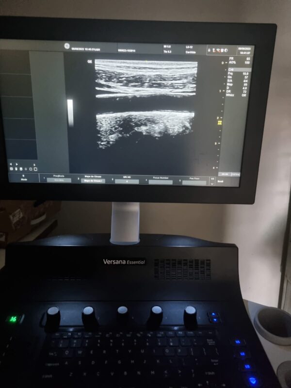 ULTRASSOM GE – VERSANA ESSENTIAL - Image 5