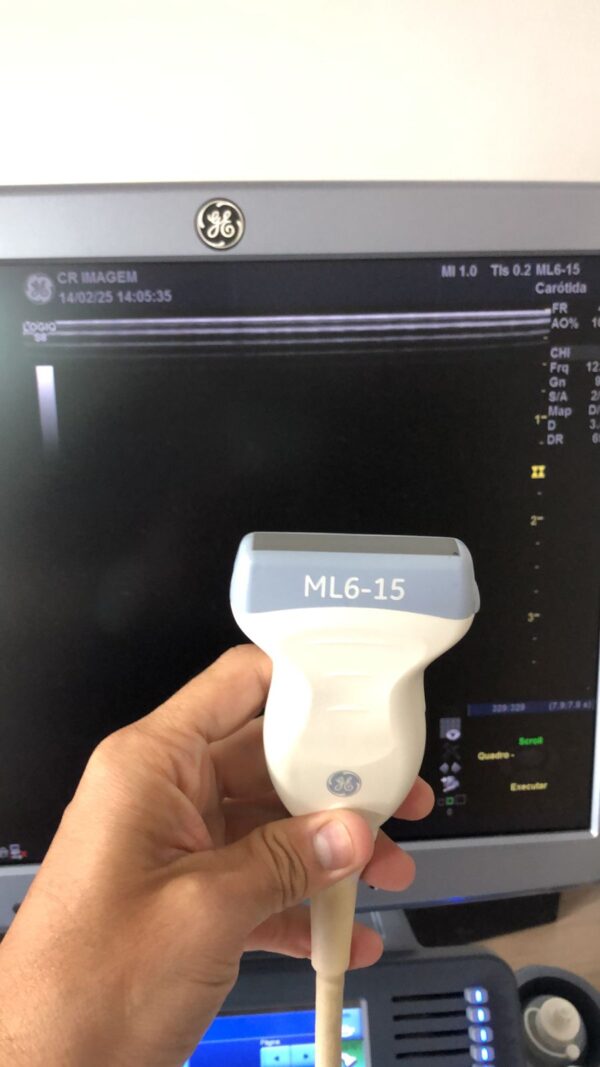 TRANSDUTOR GE – LINEAR MATRICIAL – ML6-15-D - Image 3