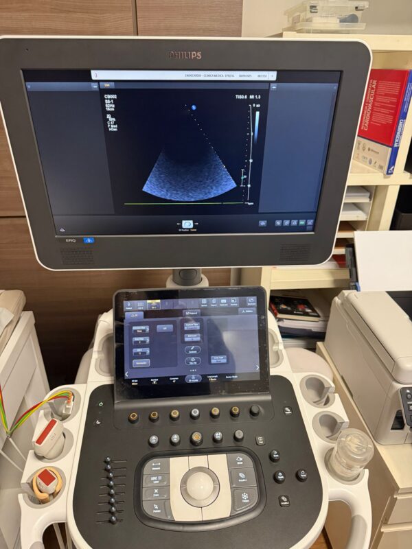 ULTRASSOM PHILIPS – EPIC ELITE - Image 2