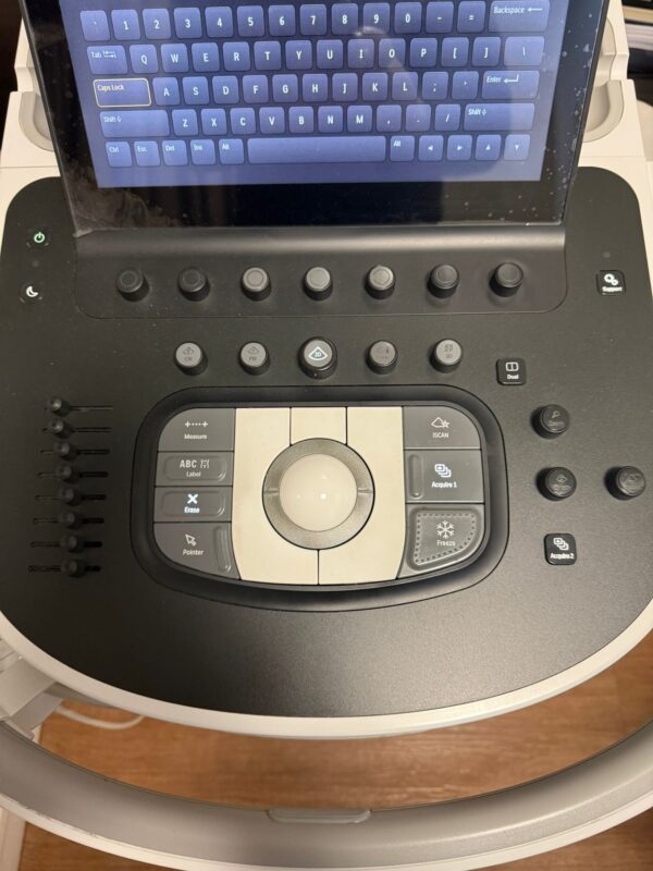 ULTRASSOM PHILIPS – EPIC ELITE - Image 4
