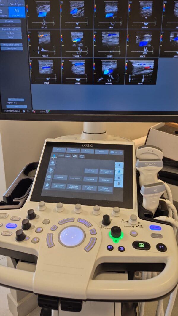 ULTRASSOM GE – LOGIQ P10 SHEAR WAVE - 3D/4D - Image 2