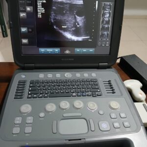 ULTRASSOM PORTÁTIL SIEMENS – ACUSON P500
