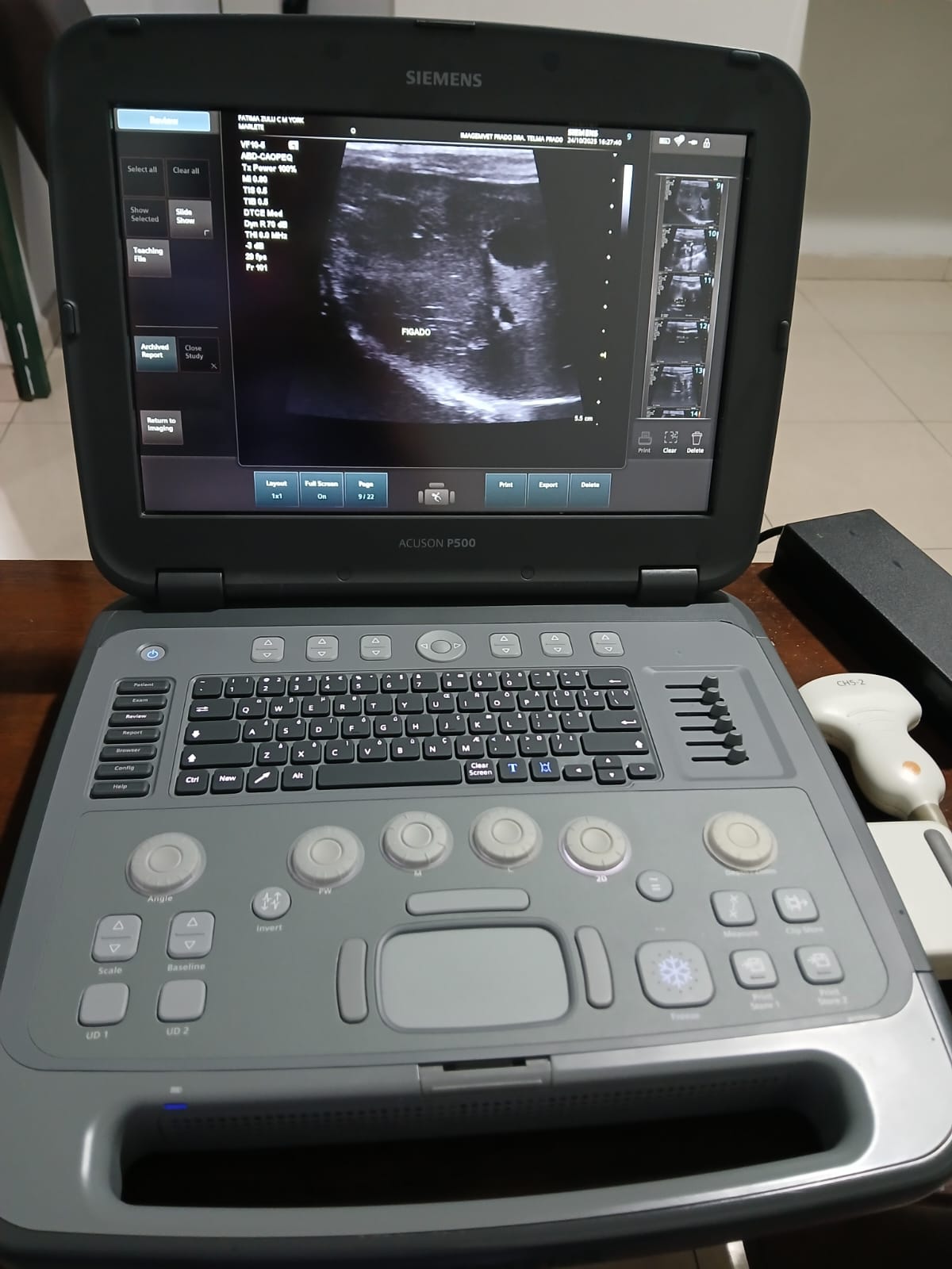 ULTRASSOM PORTÁTIL SIEMENS – ACUSON P500