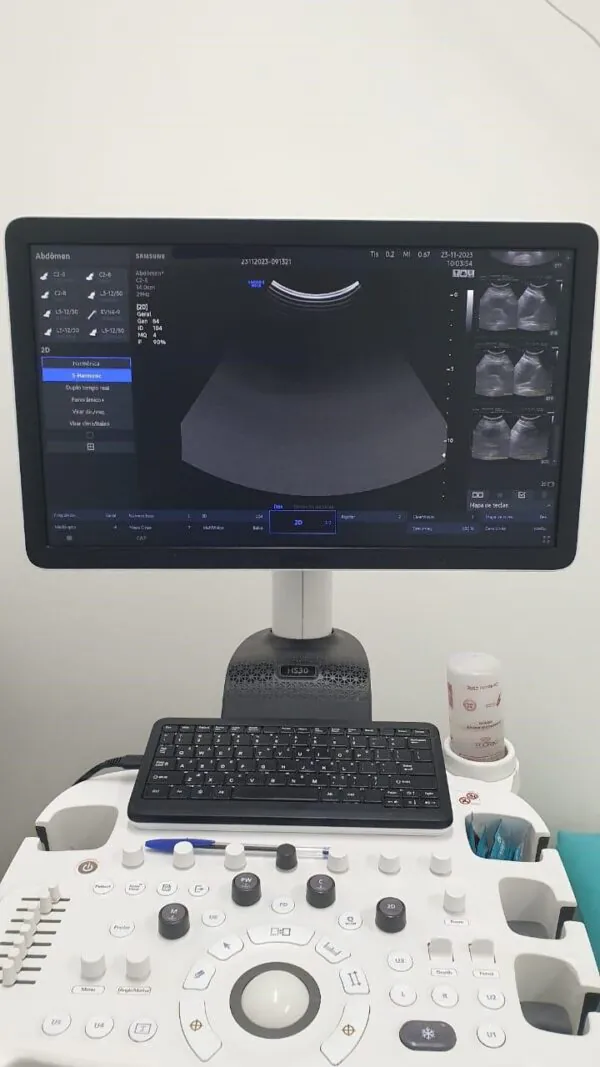 ULTRASSOM SAMSUNG - HS30