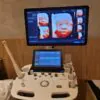 ULTRASSOM SAMSUNG – HS40 3D/4D - Image 4