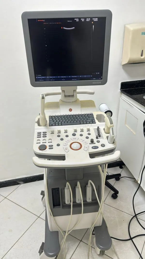 ULTRASSOM SAMSUNG – SONOACE R7 - CARDIO
